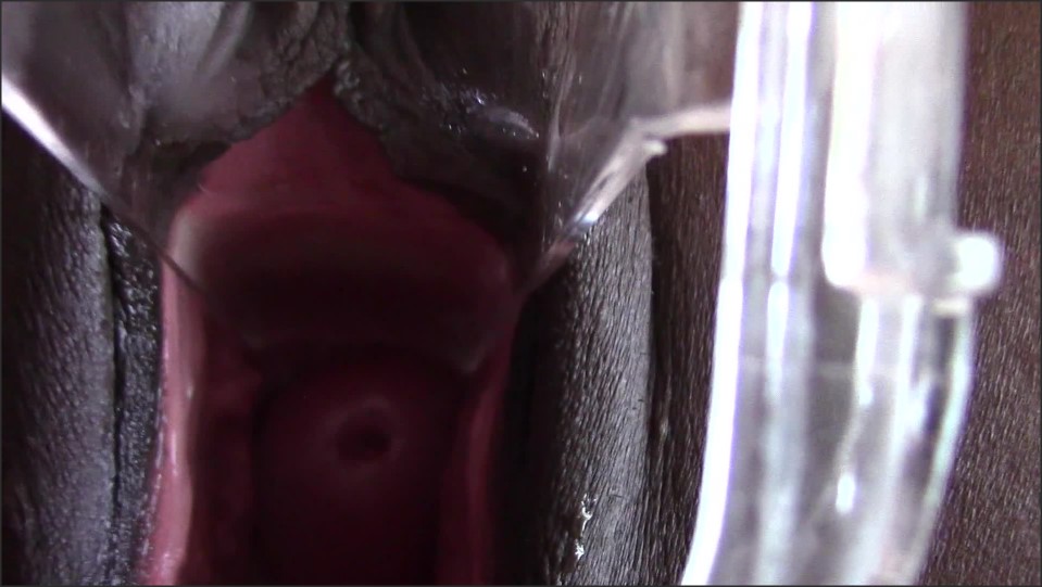 Totalpussy Secretarys Speculum Cervix
