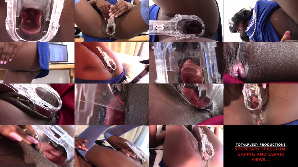 Totalpussy Secretarys Speculum Cervix