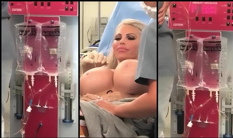 amanda_lovelie 05 03 2019 24096439 In April this machine and these two big syringes will be working there magic on me again,